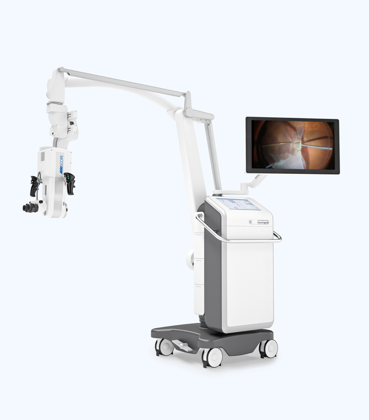 MSI Operationsmikroskop: Software für die digitale Mikrochirurgie